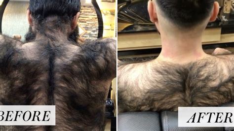 This Mans Back Hair Transformation Is Going Viral On Instagram Allure