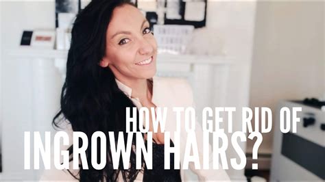 How To Get Rid Of Ingrown Hair Youtube