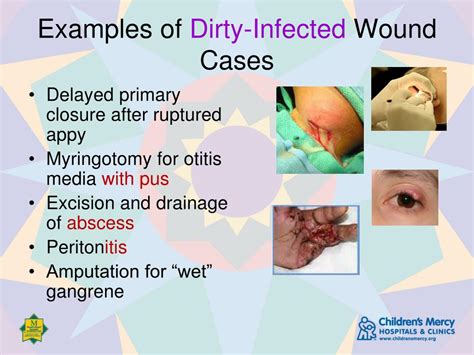 Ppt Wound Classification Powerpoint Presentation Free Download Id