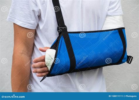 Man With Broken Arm Wrapped Medical Cast Plaster And Blue Bandage