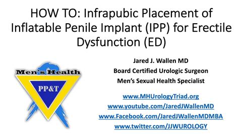How To Infrapubic Placement Of Inflatable Penile Implant Ipp For Erectile Dysfunction Ed