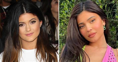 Kylie Jenner Transformation Photos See How Shes Changed