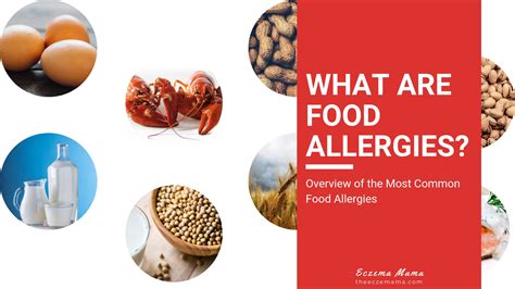 What Are Food Allergies Symptoms And Causes Eczema Mama
