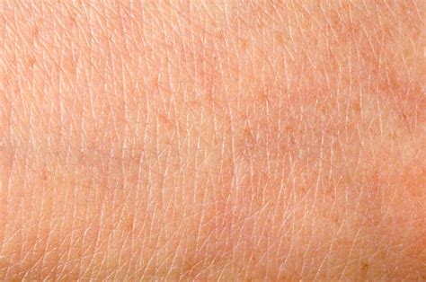 Best Human Skin Texture Stock Photos Pictures And Royalty Free Images