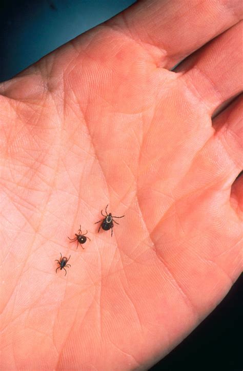 7 Lone Star Tick Symptoms To Look Out For If You Think Youve Been Bitten