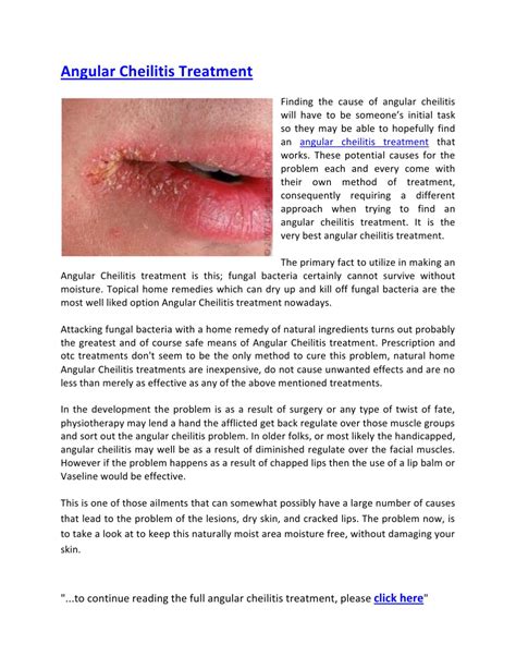Angular Cheilitis Treatment By Raymond Cc Issuu