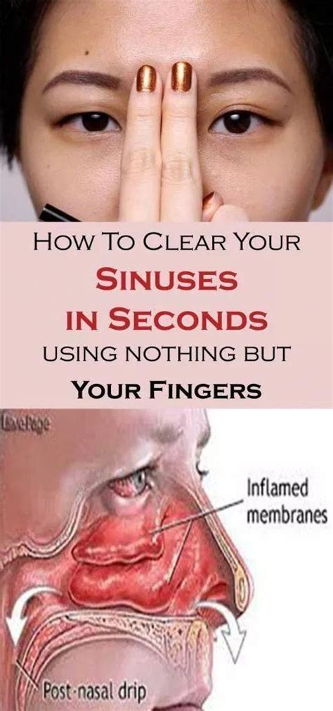 Diy How To Clear Your Sinuses In Seconds Using Nothing But Your Fingers In 2020 Sinusitis