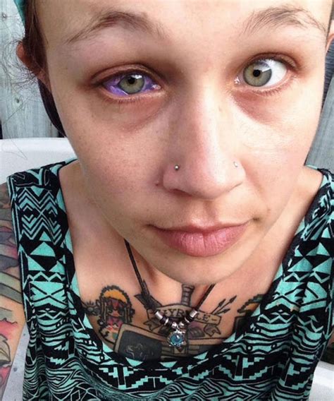 Botched Eyeball Tattoo Leaves Woman Crying Blue Tears