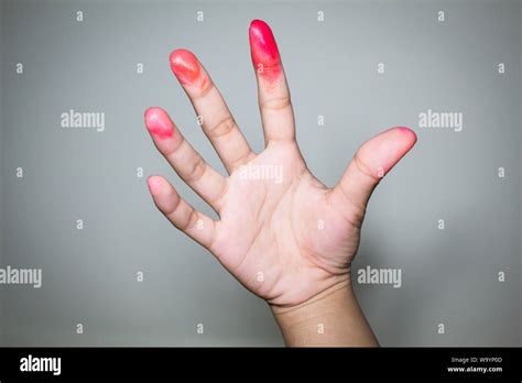 Bloody On The Fingers Of A Zombie In A Halloween Festival Stock Photo