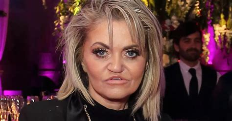 Daniella Westbrook Regrets Nightmare Surgery After Being Left With Huge Hole In Head Daily