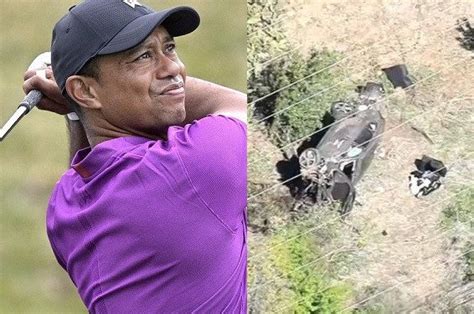 Golf Legend Tiger Woods Hospitalized With Multiple Leg Injuries After Single Vehicle Accident