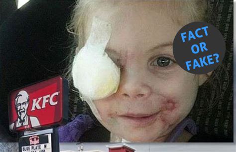 Fact Or Fake 60 Did Kfc Really Kick A Disfigured 3 Year Old Out Of