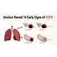 Doctors Reveal 10 Early Signs Of COPD  7 Minute Read