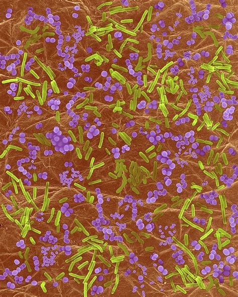 Bacteria On Human Skin Photograph By Dennis Kunkel Microscopyscience
