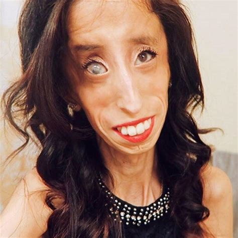 Capitán del real madrid c.f y de la selección española de fútbol. Lizzie Velasquez wurde als "hässlichste Frau der Welt" | BRAVO