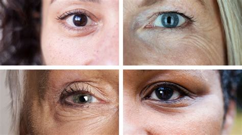 Many People Experience Crepey Skin Under Eyes They Take The Form Of