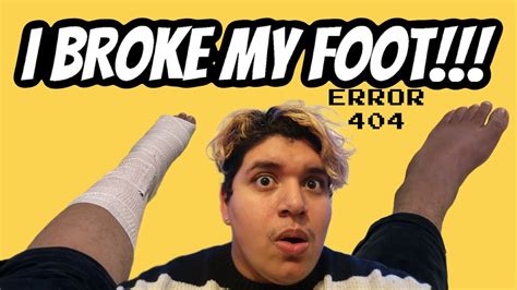 I Broke My Foot Youtube