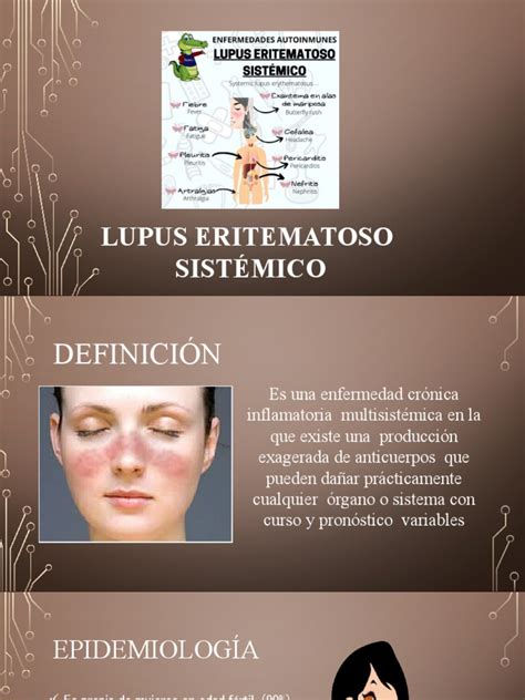 Lupus Eritematoso Sistémico Pdf Rtt Inmunología