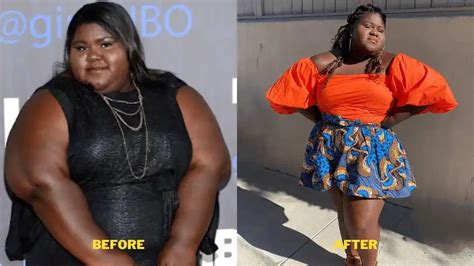 Gabourey Sidibe Weight Loss 2023 Gabbys Surgery Diet And Ozempic Use Details