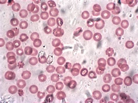 | meaning, pronunciation, translations and examples. Ficheiro:Humanrbc1000x.jpg - Wikipedia, a enciclopedia libre