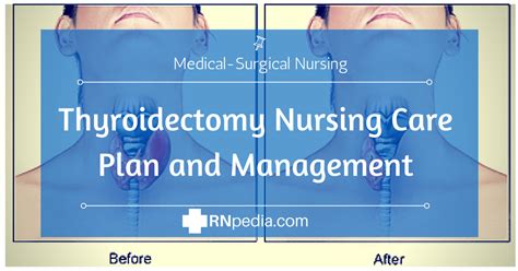 Thyroidectomy Nursing Care Plan And Management Rnpedia