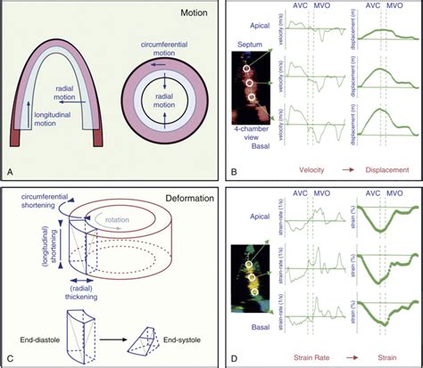 Physical Principles Of Ultrasound And Generation Of Images Thoracic Key