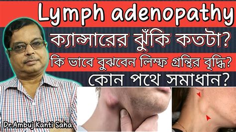 The Lump In The Neck A Swollen Lymph Node Or Else Homeopathic