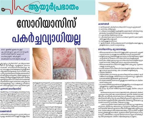 All You Need To Know About Psoriasis Symptoms Causes And Treatment