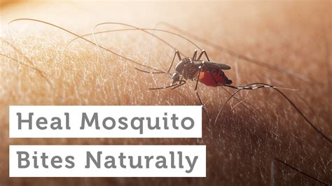 How To Heal Mosquito Bites Naturally Youtube