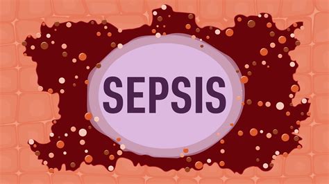 Sepsis Ausmed Course 08 Cpd Hours