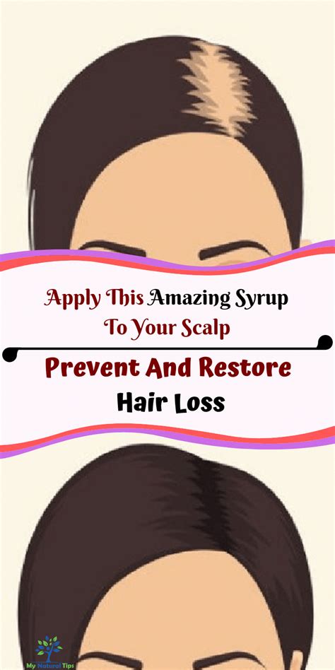 Prevent And Restore Hair Loss With This Amazing Syrup By Applying It To