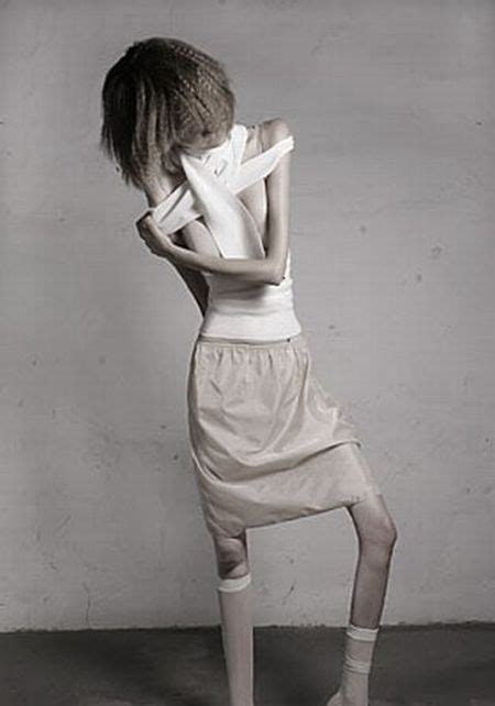 anorexia it s terrifying 14 pics