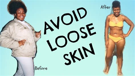 Avoid Loose Skin DURING And AFTER Weight Loss Tips For Your BEST