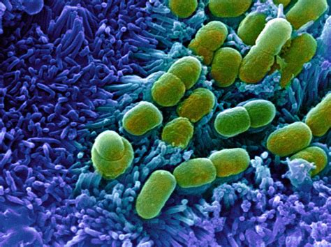 E Coli Bacteria Sem Photograph By Stephanie Schuller Fine Art America