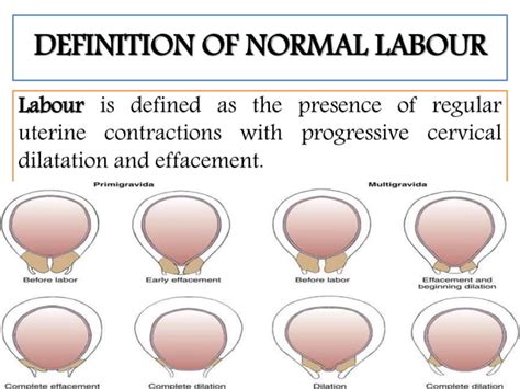 Normal Labour And Physiology Of Normal Labour Ppt