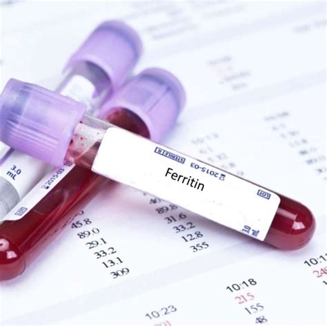 Serum Ferritin Level Blood Test Vip Lab
