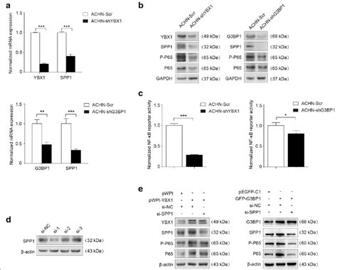 Ybx1g3bp1 Complex Up Regulates Spp1 To Activate Downstream Nf κb