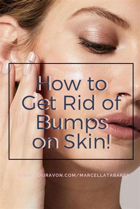 How To Get Rid Of Bumps On Your Skin Rough Bumpy Skin Bumpy Skin