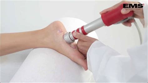 Does Shock Wave Therapy Really Work Fitter Feet For Life
