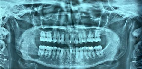 Oral And Maxillofacial Pathology — Omf Clinic