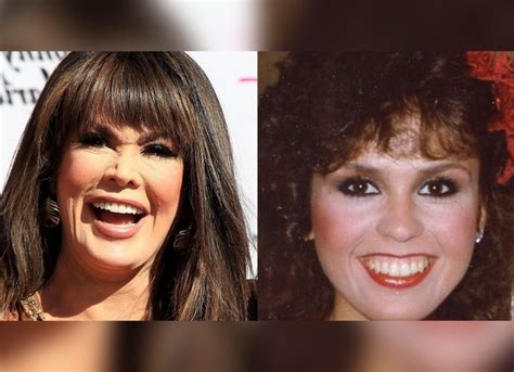 Marie Osmond Plastic Surgery Actress Has Admitted Rumors About Plastic