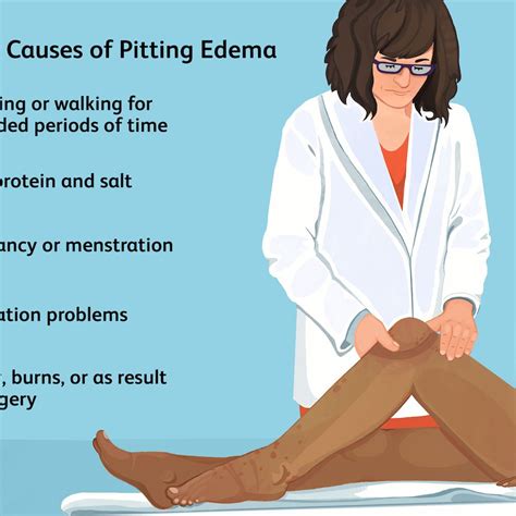 Pitting Edema Stages