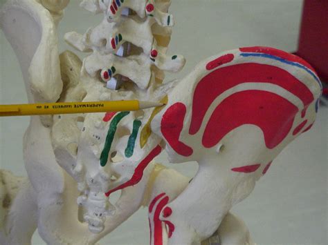 Epidemiology as with many pelvic avulsion in. Side-lying position Located in the middle of the buttocks ...