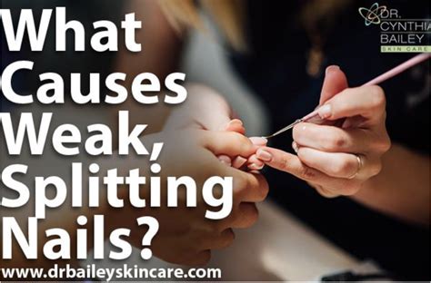 What Causes Weak Splitting Nails Split Nails Brittle Nails Weak Nails