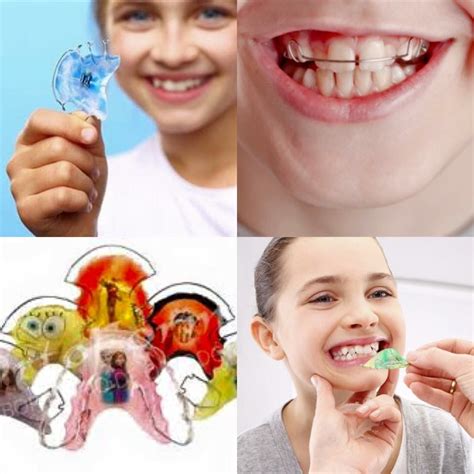 Ortodoncia Removible Dental Health Ortodoncia Ortodoncia Estetica
