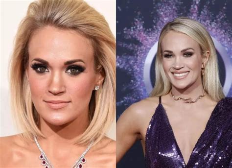 Carrie Underwood Plastic Surgery Did She Get Lip Surgery Luv68
