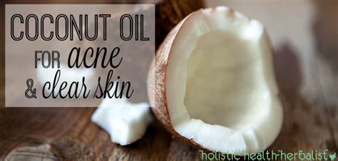Coconut Oil For Acne And Clear Skin Holistic Health Herbalist