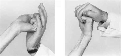 Test Wrist Flexion Physical Diagnosis Mitch Medical