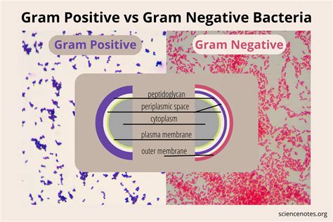 Gram Positive Vs Gram Negative Bacteria Recently Updated Trendradars
