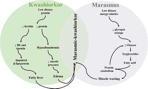 Figure 2 From Mechanisms Of Kwashiorkor Associated Immune Suppression